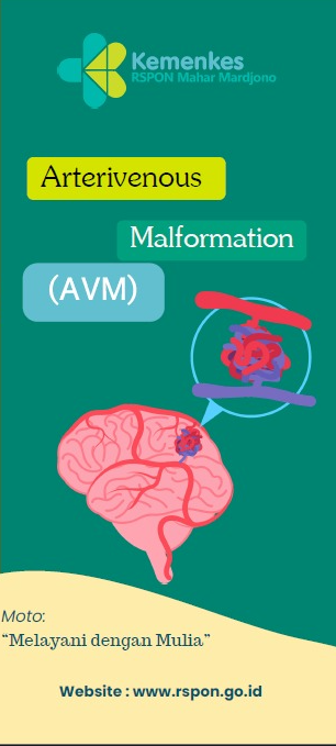 AVM (Arterivenous Malformation)